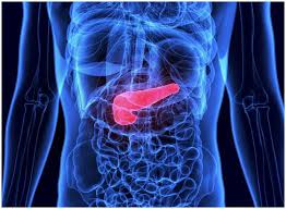 Common symptoms of pancreatic cancer include yellowing of the skin and whites of the eyes (jaundice), upper abdominal or back pain, digestive problems, and unintended weight loss. Pancreatic Cancer Sign Symptoms And Causes Excess Body Weight May Lead To This Cancer Health News India Tv