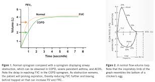 Spirometry Why How And When Pulmonology