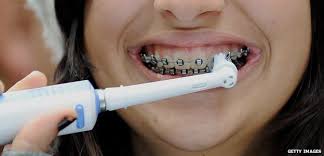 No matter the occasion or the. The Myth Of Bad British Teeth Bbc News