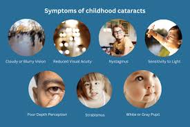 Image result for Decreased Visual Acuity