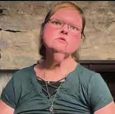 I don't mean to be rude but the only one that the surgery is working for is  Chris.