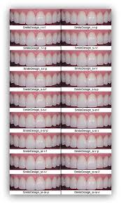 Styles Shapes Colors Of Porcelain Veneers Veneers Teeth Dental Veneers Teeth Implants
