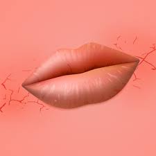 Rinse your mouth with warm salt water right after meals. What Is Angular Cheilitis The Painful Cracks Around Your Mouth Self