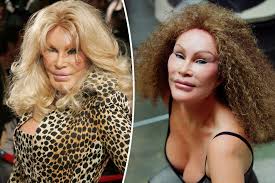 Catwoman' Jocelyn Wildenstein shares original face in old photo