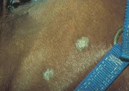 Ringworm A Fungal Infection For Horses Vetlexicon Equis From Vetstream Definitive Veterinary Intelligence Ringworm in horses by cailin bridges and holly brown. ringworm a fungal infection for
