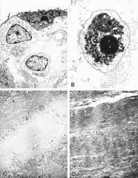 Can the net harness a bunch of volunteers to help bring books in the public domain to life through podcasting? Allograft Heart Valves The Role Of Apoptosis Mediated Cell Loss The Journal Of Thoracic And Cardiovascular Surgery