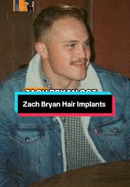 Zach Bryan Toupee