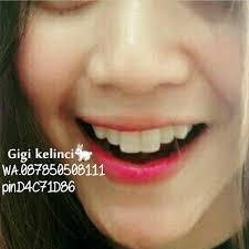 Check spelling or type a new query. Gigi Kelinci Gingsull Yg Minat Fria Dental Solo Facebook