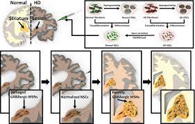Stem Cell Transplantation For Huntington S Diseases Sciencedirect