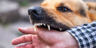 Image result for Dog Bite