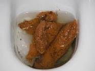 Cara buang air besar yang baık dan benar. Buang Air Besar Home Facebook