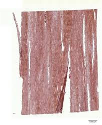 Image result for Dalbergia acutifoliolata