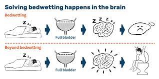 What Causes Bedwetting? It's About What Happens In A Child's Brain.