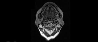 Mrt Hals Radiologie Nuklearmedizin Adickesallee