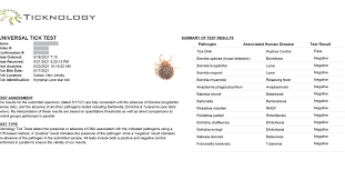 Inspect every part of your body for ticks, they can be as small as a poppy seed! We Hate Ticks Too Here S How To Protect Yourself Prevent Bites And Treat Disease Wirecutter