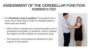 Image result for Cerebellar Function Test