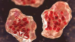 Image result for measles