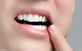 Sie können an verschiedenen stellen im. Ozon Behandlung Zahnarztpraxis Dr Bunnigmann