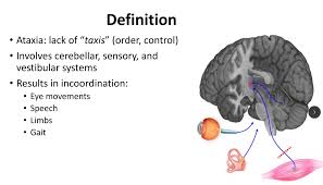 Image result for Ataxia