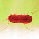 This serovar is though, very common in animals and food. Bfr Bedeutung Der Salmonellen Als Krankheitserreger