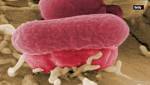  16 states affected by E. coli outbreak linked to romaine lettuce