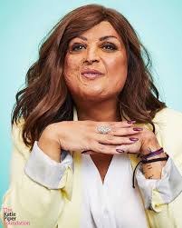 tulsidivine108 story by her own words: “Having survived a plane crash at  the age of 10 with extensive burns to both my face and body, had a renal  transplant after end stage