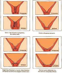 Peaceful Parenting The Myth Of The Vaginal Exam In Pregnancy