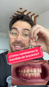 Aquí muestro colo podemo cambiar ma mordida de un paciente #sinbrackets  #CapCut #ortodoncia #ortodoncista #braces #orthodontics #ortodoncia #cdmx  #roma #condesa #polanco