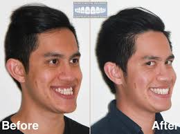 10 BEST Dentists in Byron Bay NSW 2481