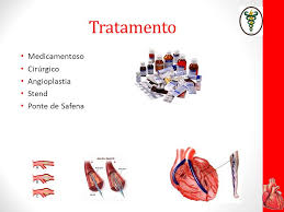 Ondas q e elevação de st alterações eletrocardiográficas no iam. Infarto Agudo Do Miocardio Ppt Video Online Carregar