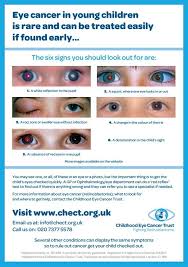 Eye cancer is a term used to explain different types of tumours of eye which arise due to uncontrolled growth of healthy cells present in and around the eye. Moorfields Eye Hospital Nhs Foundation Trust On Twitter Retinoblastoma Eye Cancer In Young Children Is Rare And Can Be Treated Easily If Found Early Know The Signs Rbweek Http T Co Kl7cejiloy