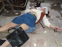 The selena autopsy photos have been temporarily removed from this site. 51467469ac1819d77d418fa412fb590b Ted Bundy Autopsy Jpg