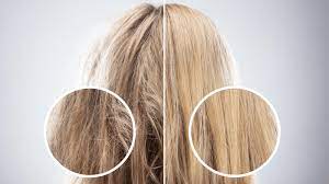 Eating disorders can cause breakage to the hair and can lead to hair loss. The Difference Between Hair Loss And Hair Breakage Trichology