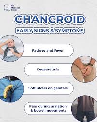 Image result for chancroid