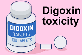 Image result for Digoxin Toxicity