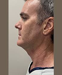 Gallery of Procedures