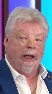Simon Weston