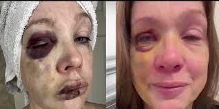 Woman attacked in viral Cincinnati brawl speaks with Tricia Macke