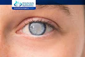 The nottingham family glaucoma screening study / br. Glaucoma Surgery Cost What Is The Success Rate Of Glaucoma Surgery