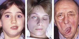 En effet pour que le vaccin soit efficace, les patients devront se faire vacciner deux fois, mais si les effets secondaires sont trop contraignants, de nombreuses personnes n'iront pas jusqu'à la. Humour Les Premiers Effets Secondaires Lies Au Vaccin Anti Covid Deja Ressentis Apres Des Personnes Vaccinees Humor The First Side Effects Related To The Anti Covid Vaccine Already Felt After People
