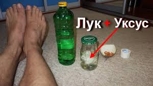 как избавиться от куриных попок на ногах в домашних условиях Shipica Podoshvennaya Mozol Ili Borodavka So Sterzhnem Uksus I Luk Proshaj Borodavki I Mozoli Youtube