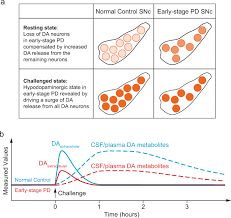 Dopamine Neuron Challenge Test For Early Detection Of Parkinson's Disease |  Npj Parkinson's Disease