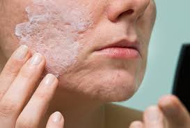 Acne causes scarring, and acne pustules can be very painful and sensitive. 3 Diy Homemade Acne Face Masks Emedihealth