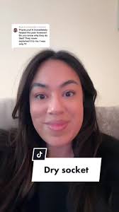 Understanding Dry Socket After Tooth Extraction