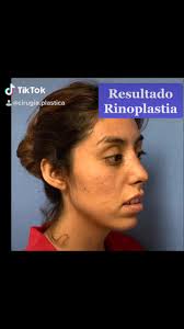 Dr. Juan M Melchor G (@cirugia.plastica)