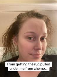 Lauren Oconnell Survivor Transformation