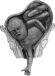 Image result for Shoulder Presentation