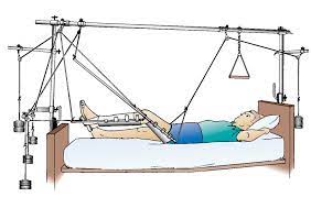 Mechanisms by which pull is exerted on the. Principles Of Effective Traction