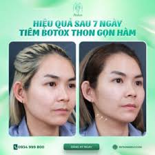 Lưu trữ Tin tức