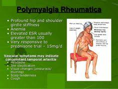 60 Polymyalgia Rheumatica Ideas Polymyalgia Rheumatica Fibromyalgia Autoimmune Disease